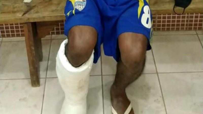 Com falsa fratura na perna, homem é flagrado tentando ingressar na CPP de Palmas com celulares escondidos em gesso