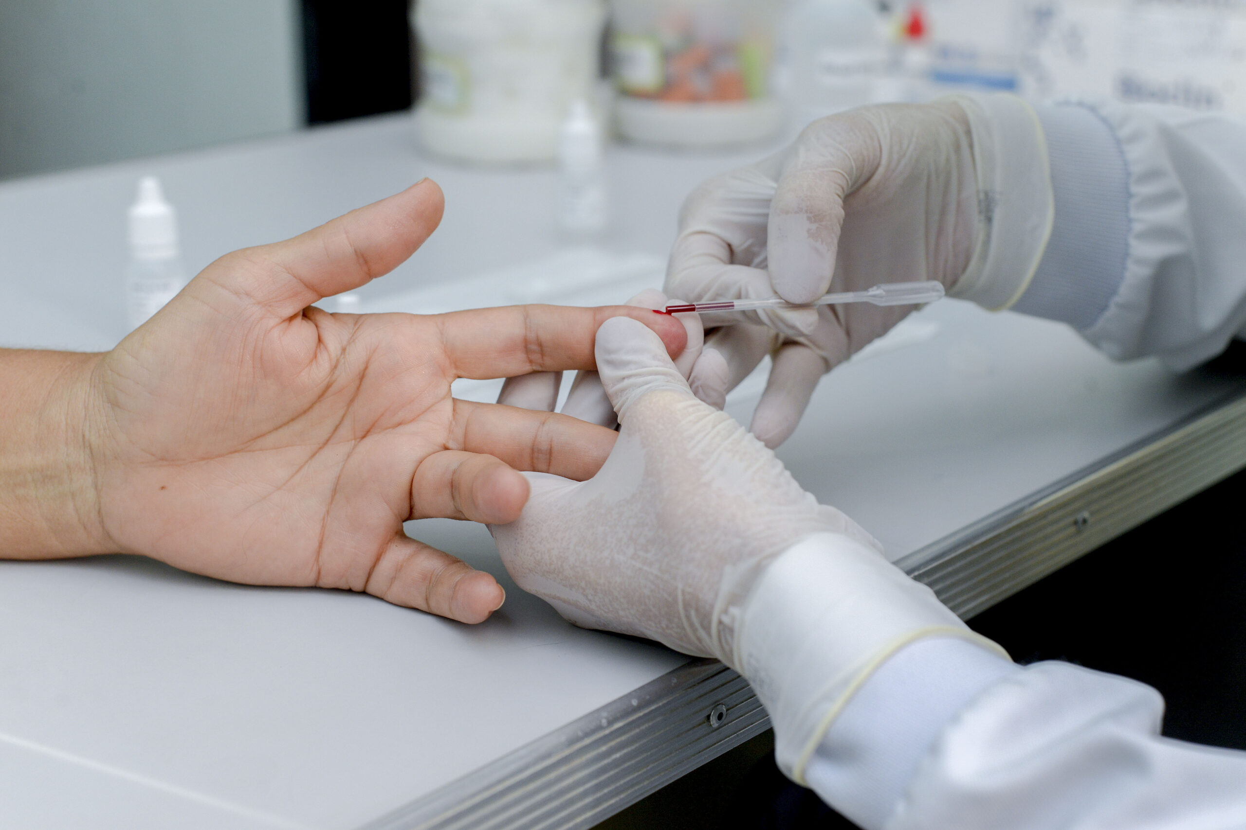 Hepatites virais: entenda como buscar diagnóstico e tratamento