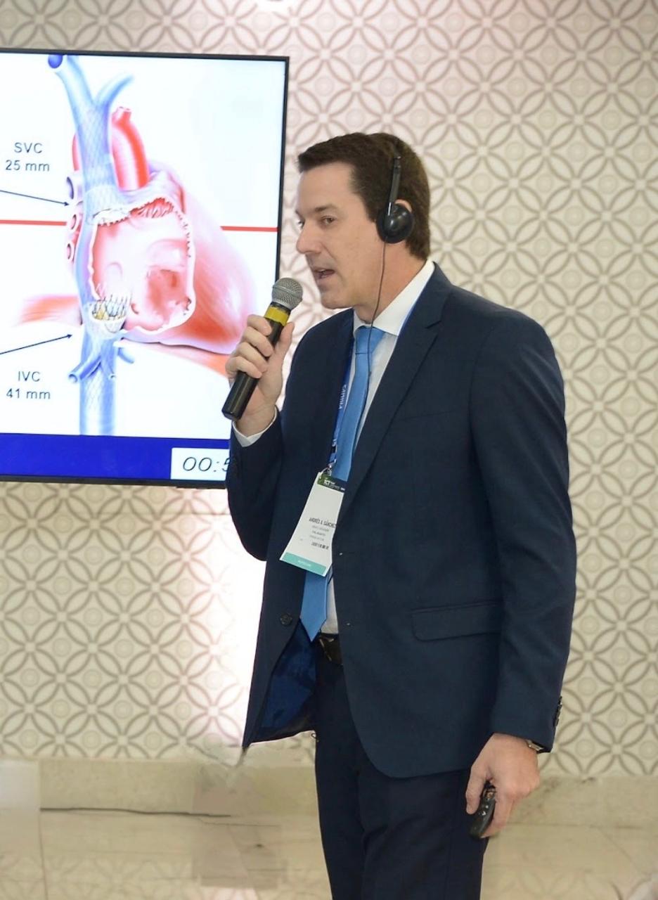 Tocantins se destaca no cenário internacional com procedimento raro em cardiologia intervencionista